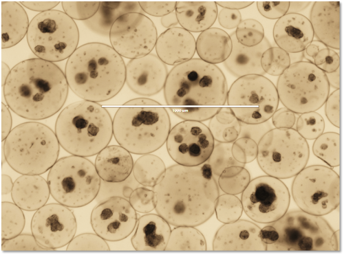 Human islets encapsulated for cell therapy