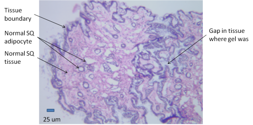 Histology adjacent to biocompatible depot